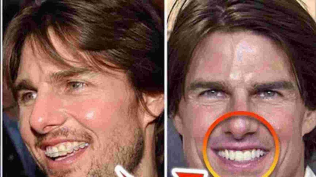 Tom Cruise Teeth