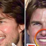 Tom Cruise Teeth